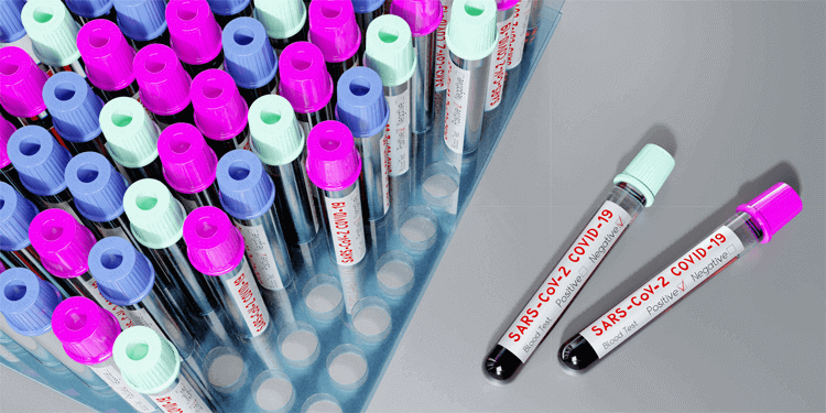 How Secure and Scalable is Your Lab Testing Tracking System